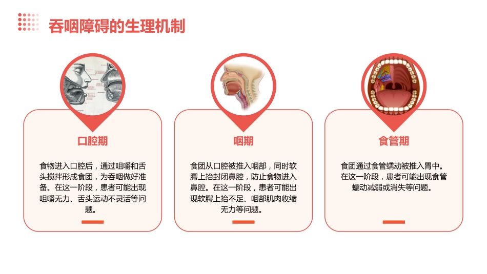 脑卒中后吞咽障碍患者进食护理PPT_第8页