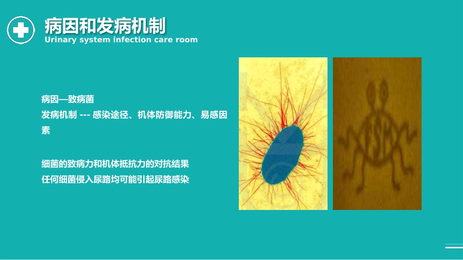 外科护理：泌尿外科护理查房PPT_第8页