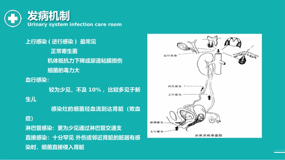 外科护理：泌尿外科护理查房PPT_第9页