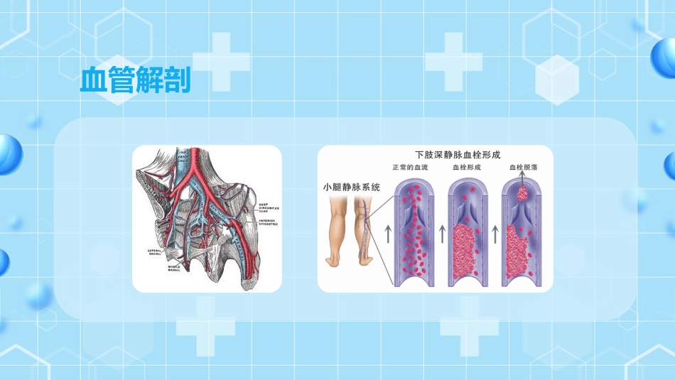 外科护理：下肢静脉血栓的护理查房ppt_第11页