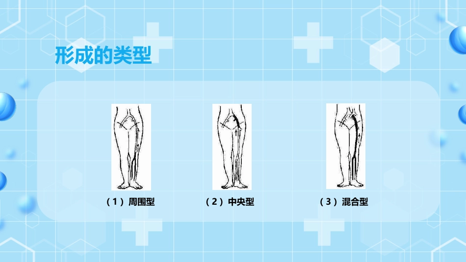 外科护理：下肢静脉血栓的护理查房ppt_第15页