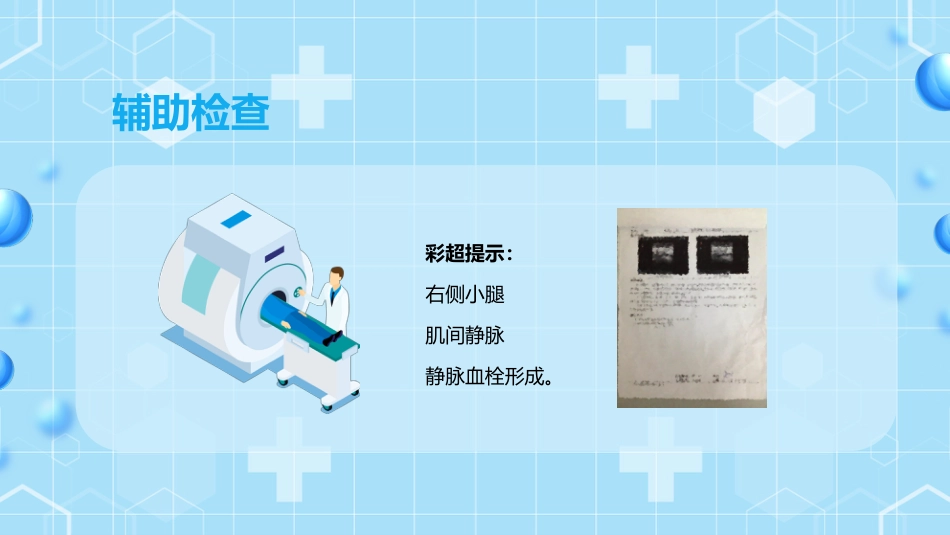 外科护理：下肢静脉血栓的护理查房ppt_第7页
