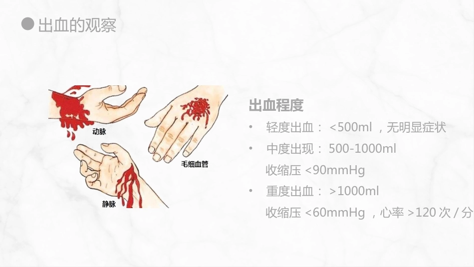 外科护理：出血的观察和护理_第10页
