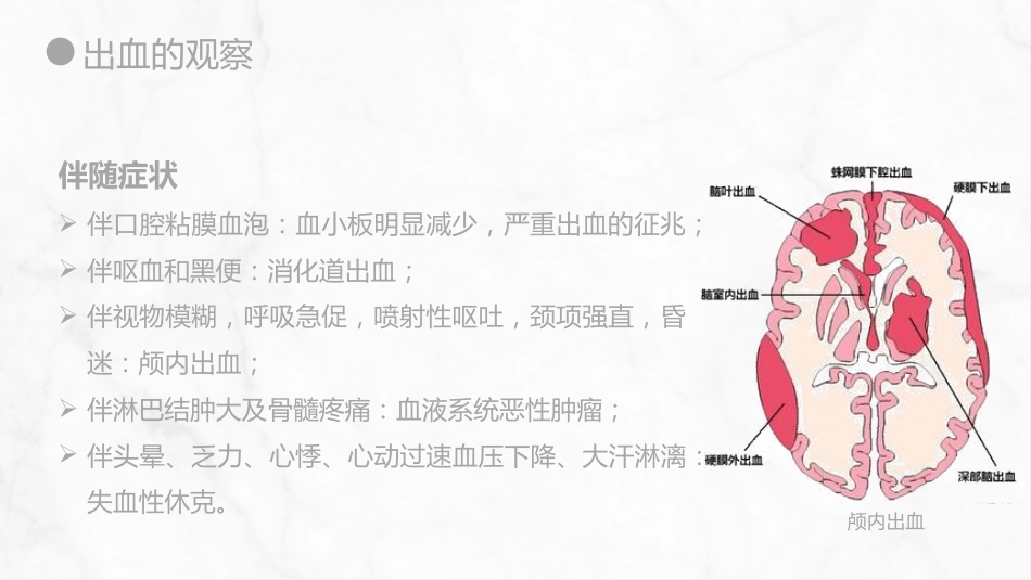 外科护理：出血的观察和护理_第11页