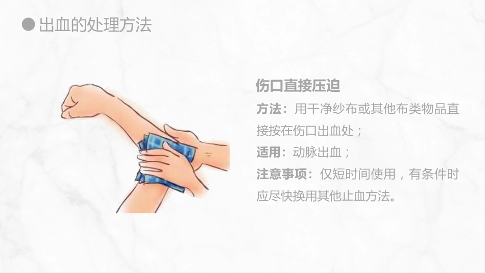 外科护理：出血的观察和护理_第12页