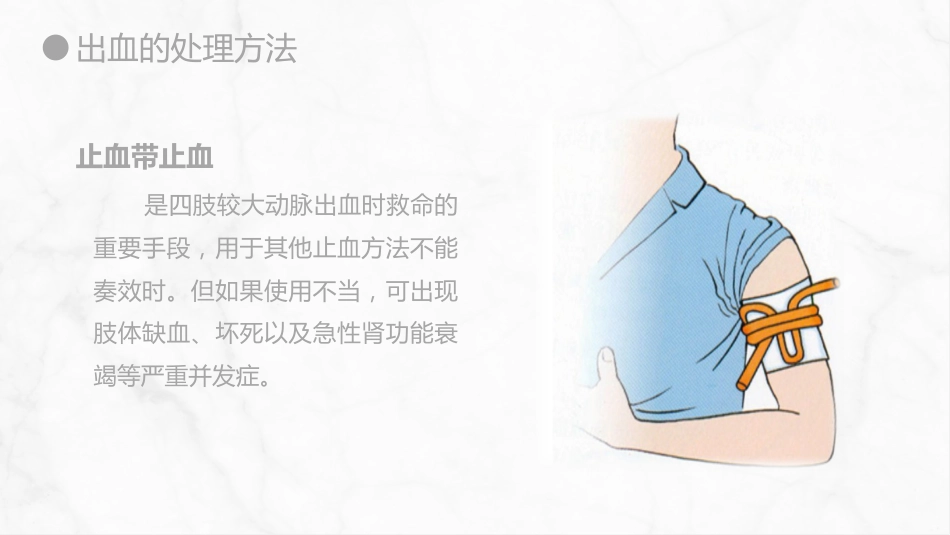 外科护理：出血的观察和护理_第15页