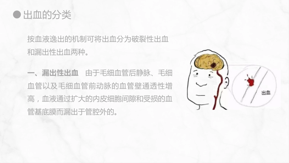 外科护理：出血的观察和护理_第5页
