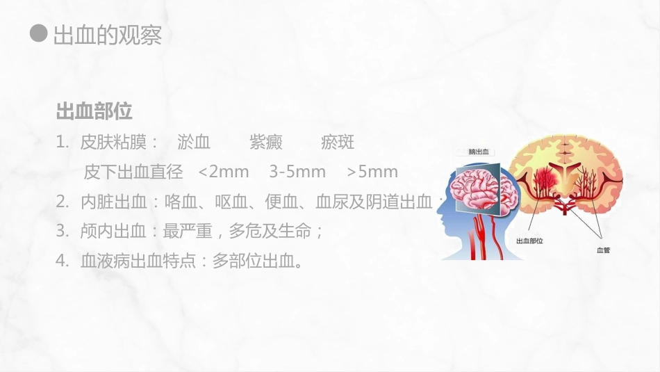 外科护理：出血的观察和护理_第9页