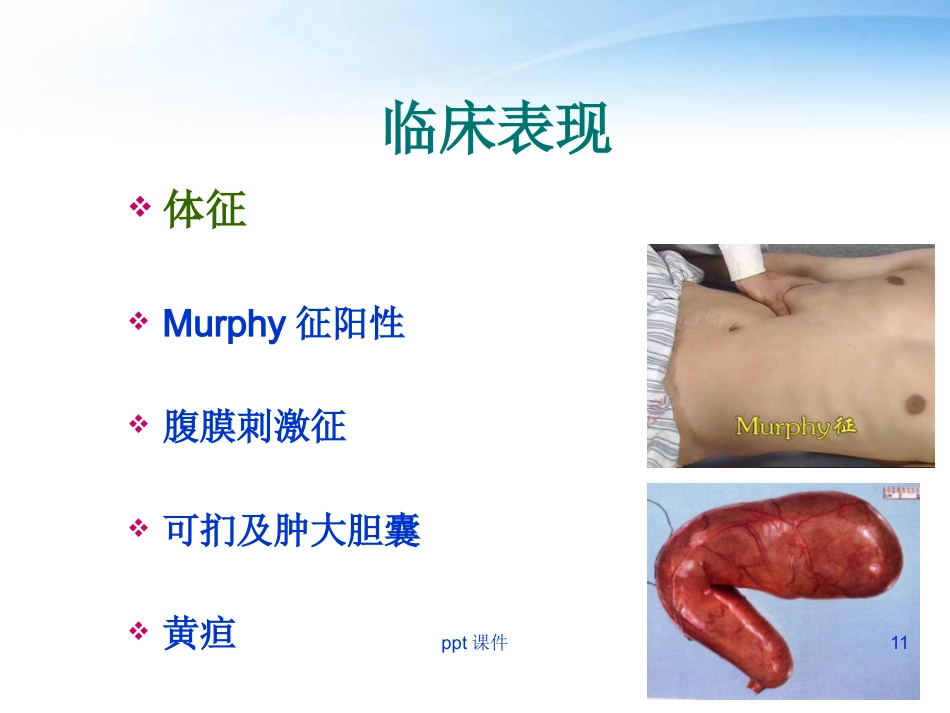胆囊炎胆囊结石病人护理_第11页