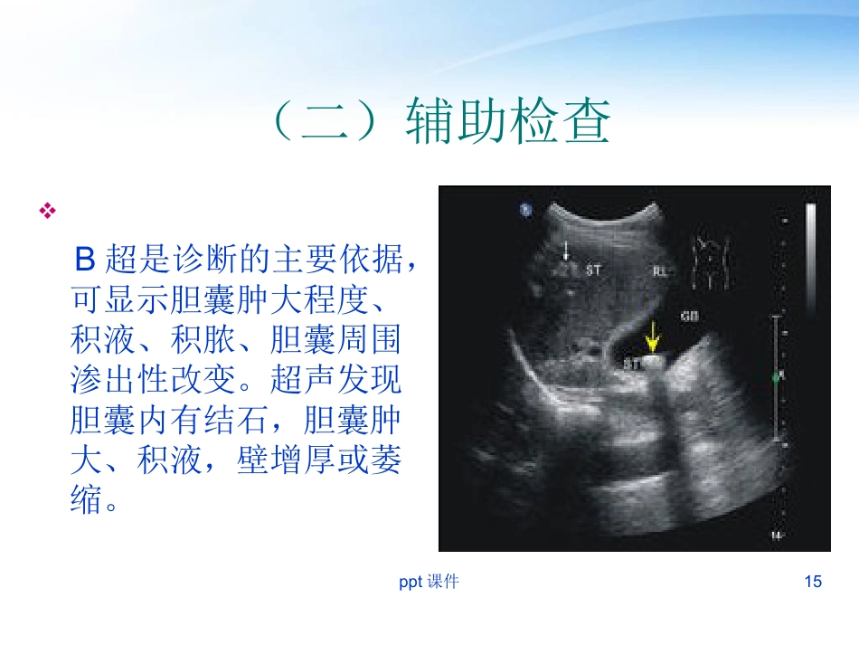 胆囊炎胆囊结石病人护理_第15页
