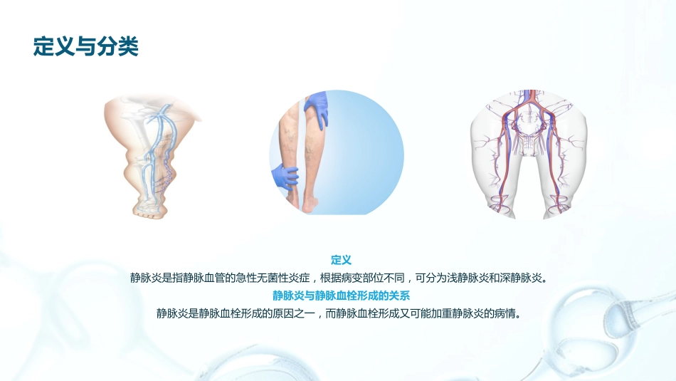 静脉输液发生静脉炎的预防及护理_第4页