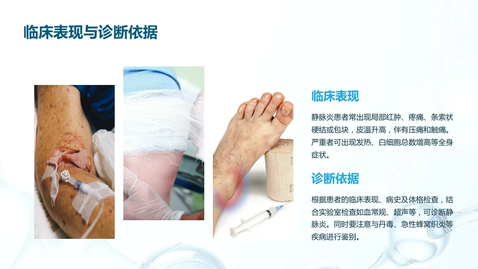 静脉输液发生静脉炎的预防及护理_第6页