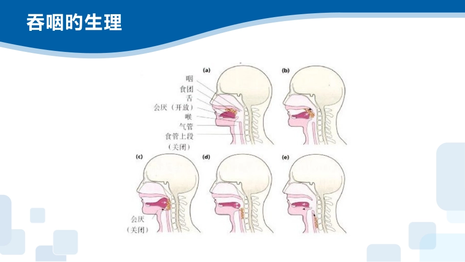 吞咽障碍的康复护理_第6页