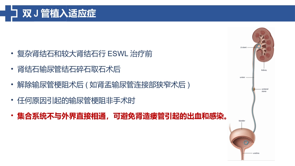 双J管置入术后护理_第8页