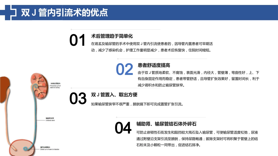 双J管置入术后护理_第9页