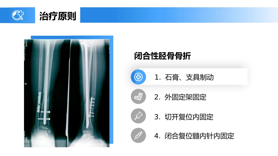 外科护理：胫腓骨骨折护理_第11页
