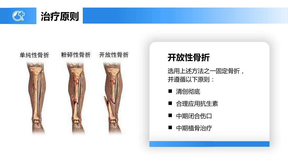 外科护理：胫腓骨骨折护理_第12页