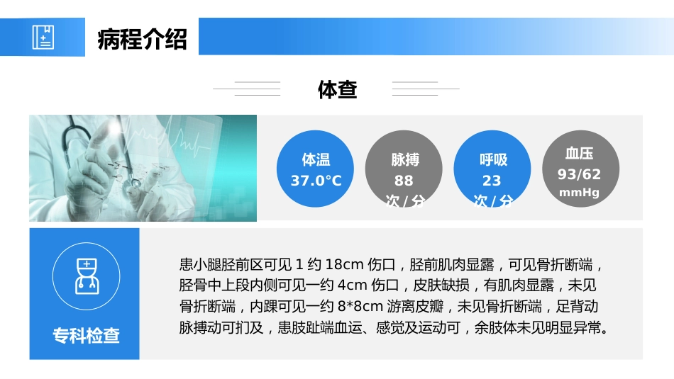 外科护理：胫腓骨骨折护理_第15页