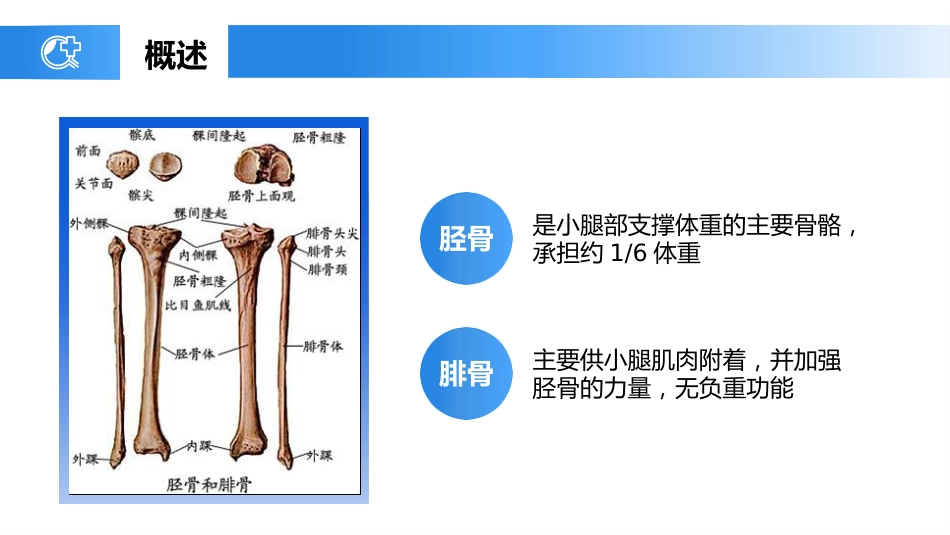 外科护理：胫腓骨骨折护理_第4页