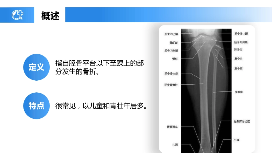 外科护理：胫腓骨骨折护理_第5页