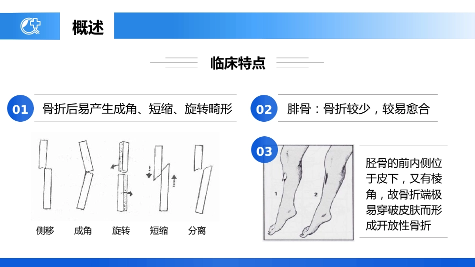 外科护理：胫腓骨骨折护理_第6页