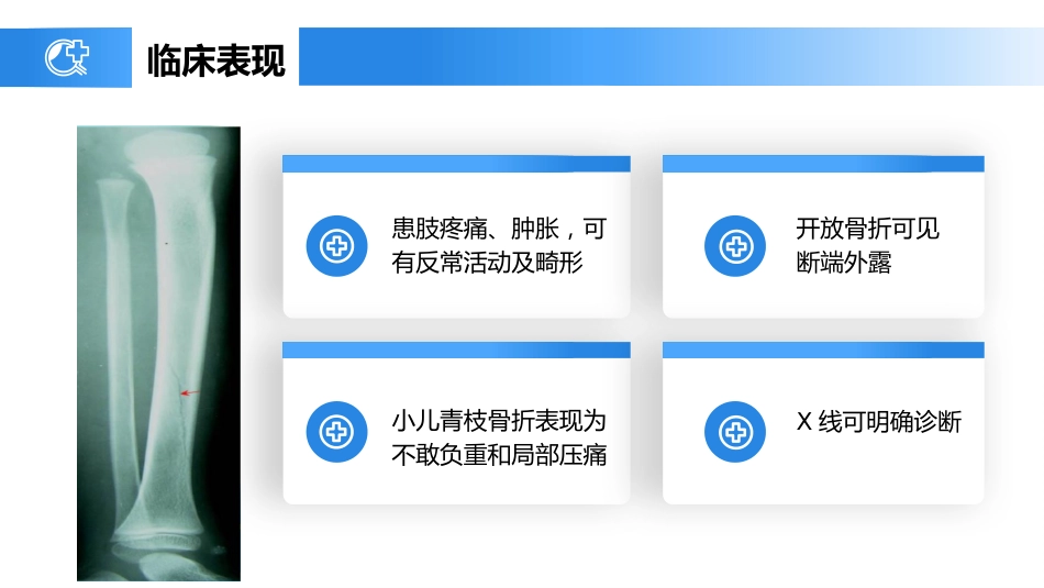 外科护理：胫腓骨骨折护理_第9页