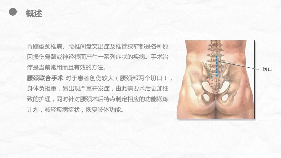外科护理：腰颈椎联合手术患者术后护理课件_第4页