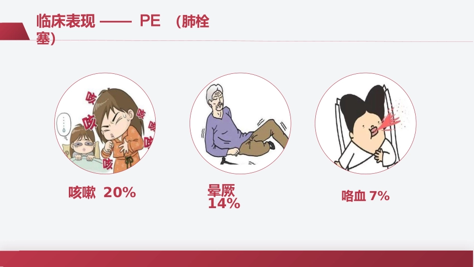 VTE的预防及护理措施(静脉血栓栓塞症相关知识)_第12页