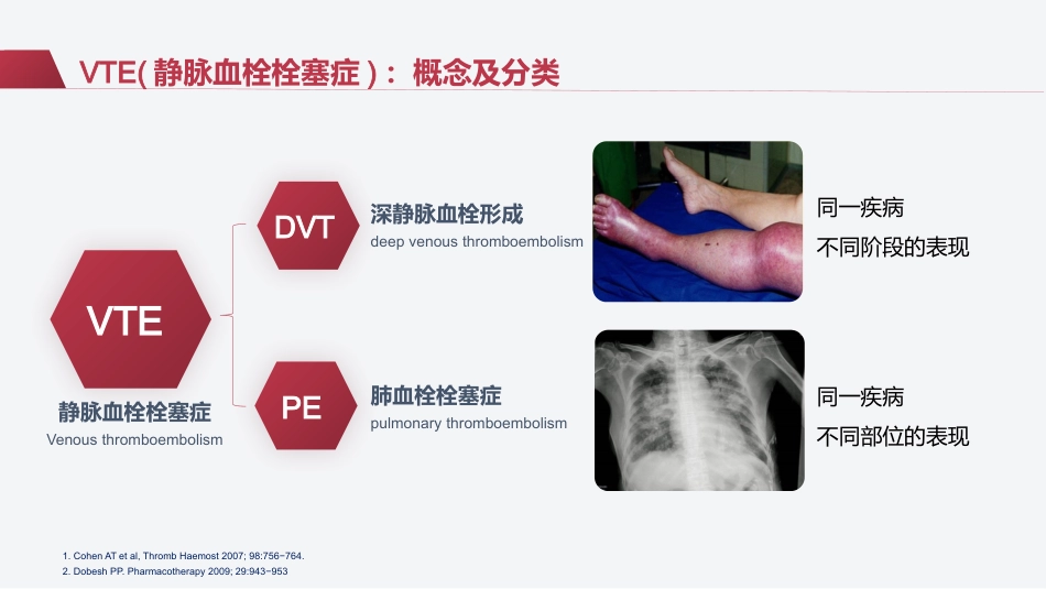 VTE的预防及护理措施(静脉血栓栓塞症相关知识)_第7页