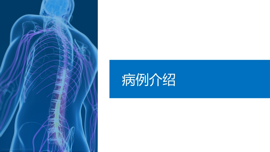 颈椎骨折脊髓损伤护理查房ppt精选全文_第4页