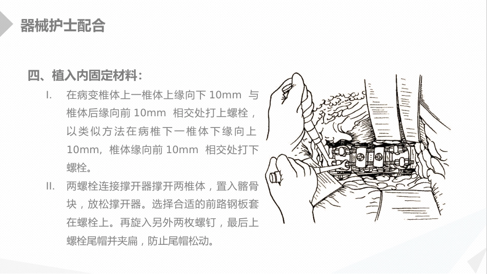 外科护理：经前路腰椎手术的综合护理_第14页