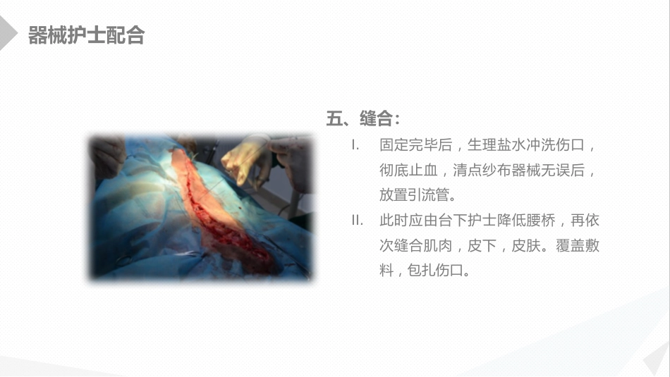 外科护理：经前路腰椎手术的综合护理_第15页