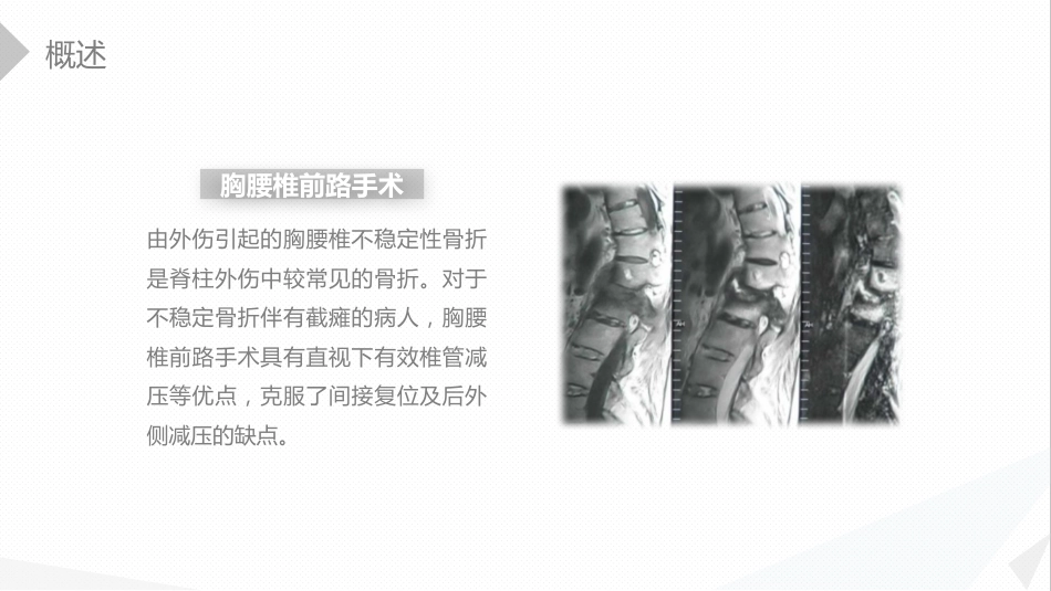 外科护理：经前路腰椎手术的综合护理_第4页