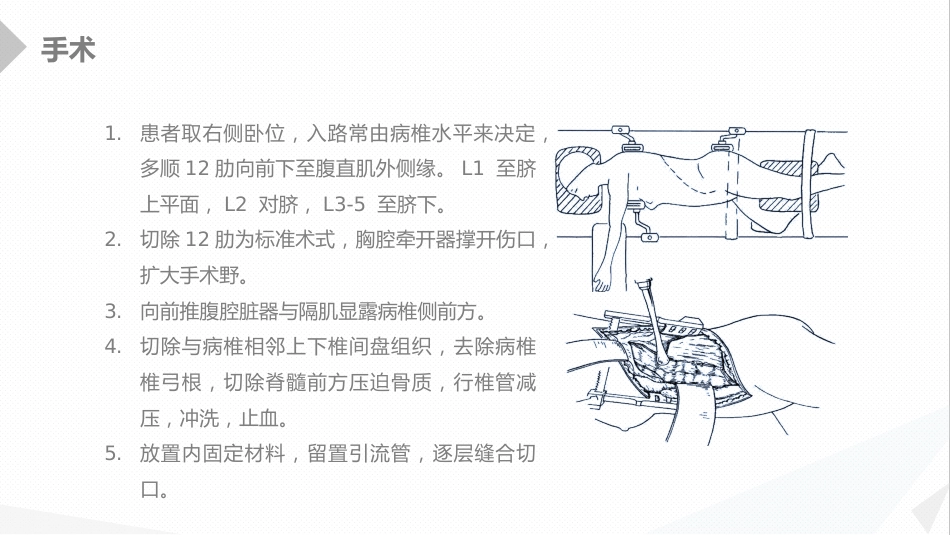 外科护理：经前路腰椎手术的综合护理_第6页