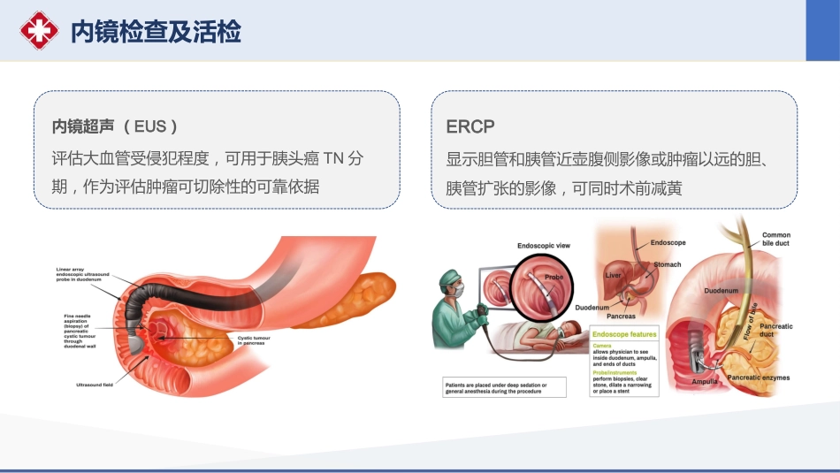 胰十二指肠切除术护理查房_第10页