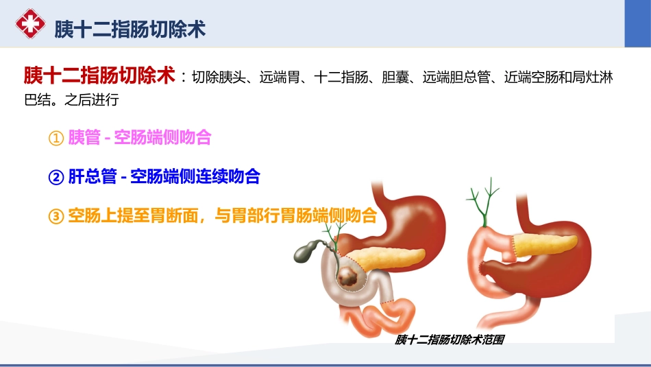 胰十二指肠切除术护理查房_第13页