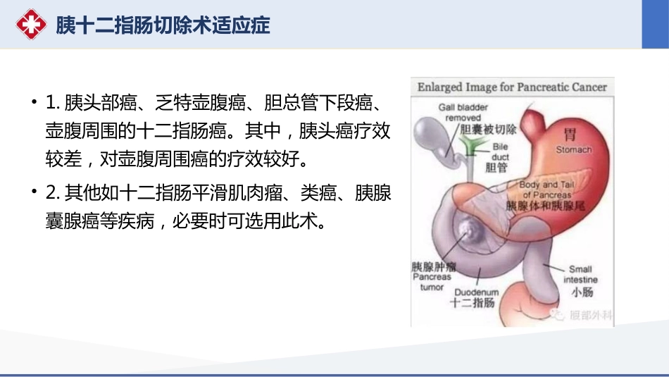 胰十二指肠切除术护理查房_第14页