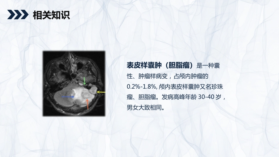 外科护理：颅内表皮样囊肿患者的护理查房_第4页