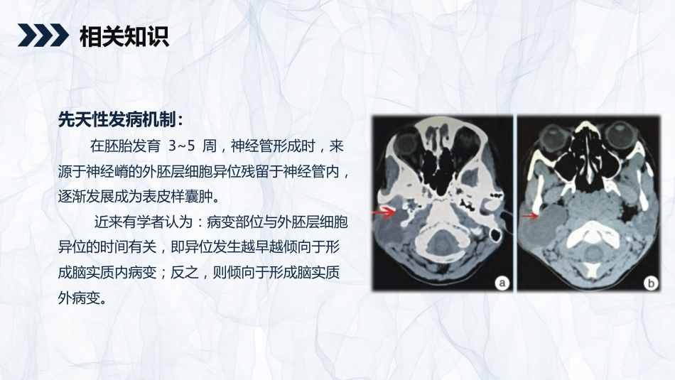 外科护理：颅内表皮样囊肿患者的护理查房_第5页