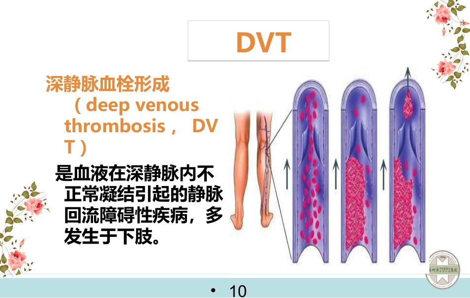 静脉血栓栓塞症的预防与护理_第10页