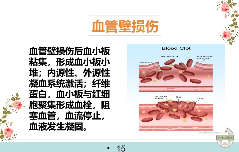 静脉血栓栓塞症的预防与护理_第15页