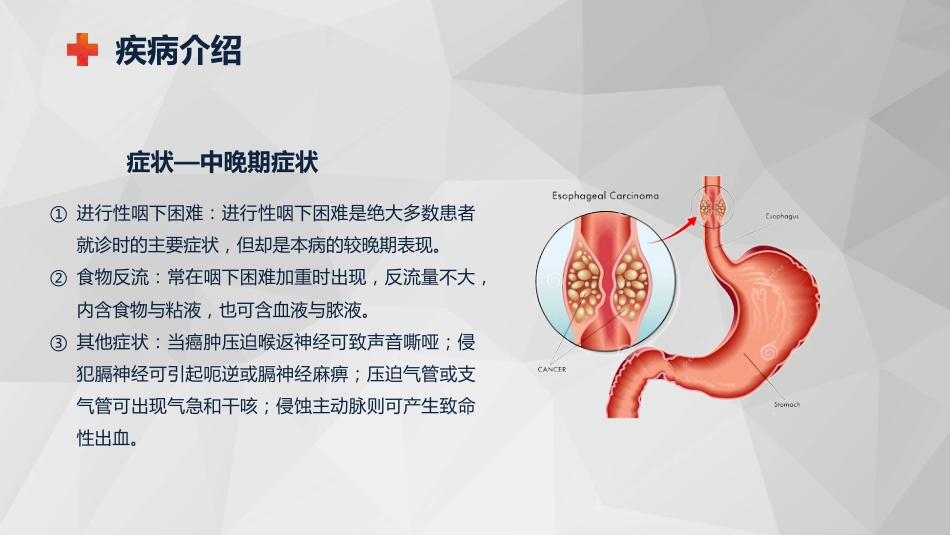 外科护理：食管癌的护理查房知识课件_第10页