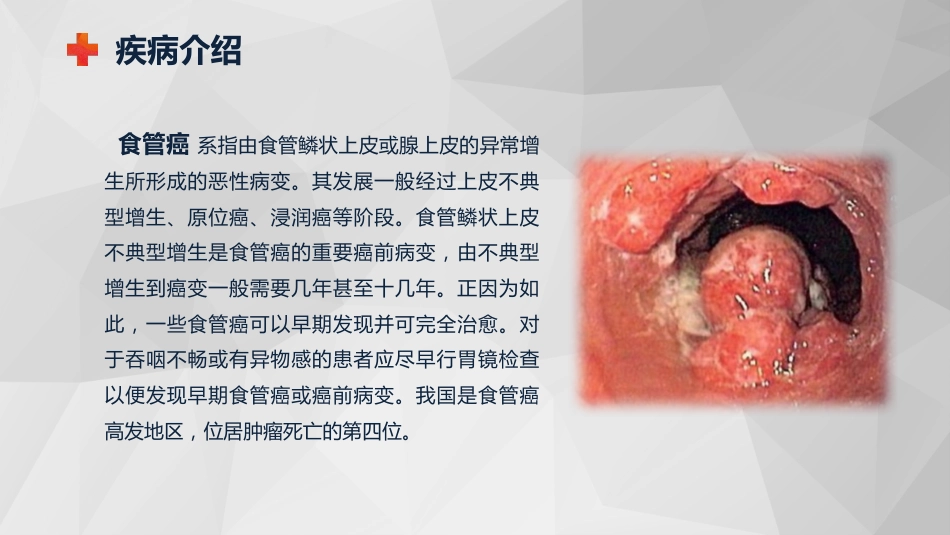 外科护理：食管癌的护理查房知识课件_第5页