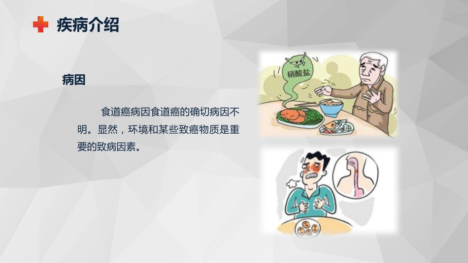 外科护理：食管癌的护理查房知识课件_第6页