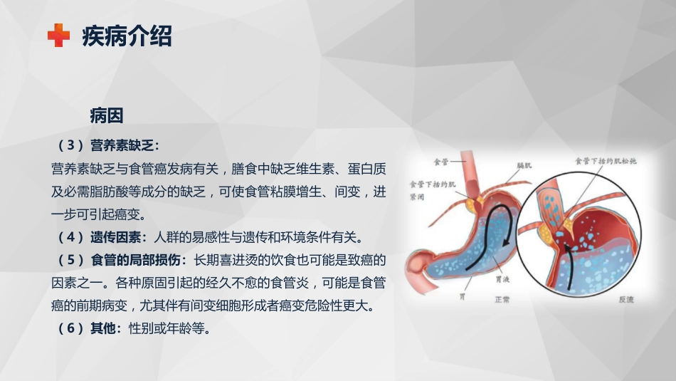 外科护理：食管癌的护理查房知识课件_第8页