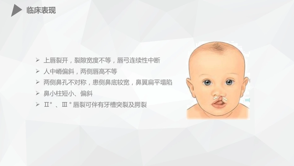 外科护理：幼儿唇裂的护理查房_第10页