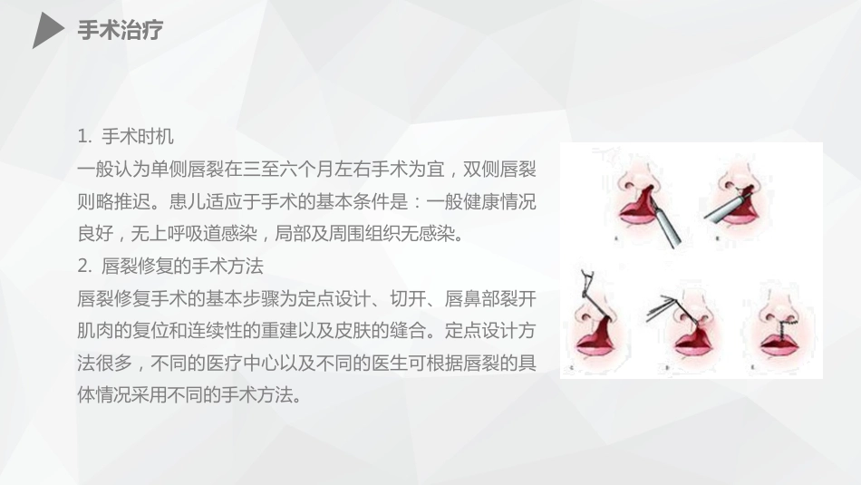 外科护理：幼儿唇裂的护理查房_第12页