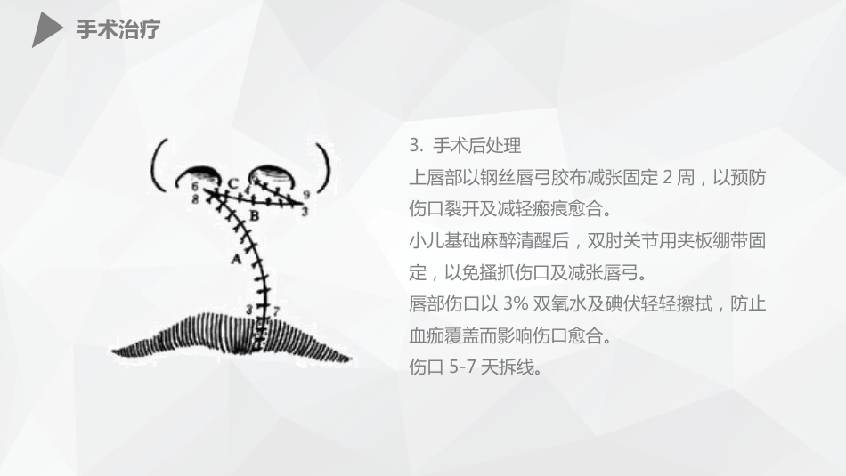 外科护理：幼儿唇裂的护理查房_第13页