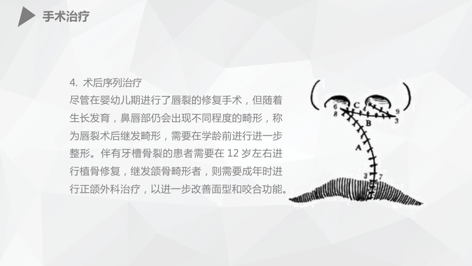 外科护理：幼儿唇裂的护理查房_第14页