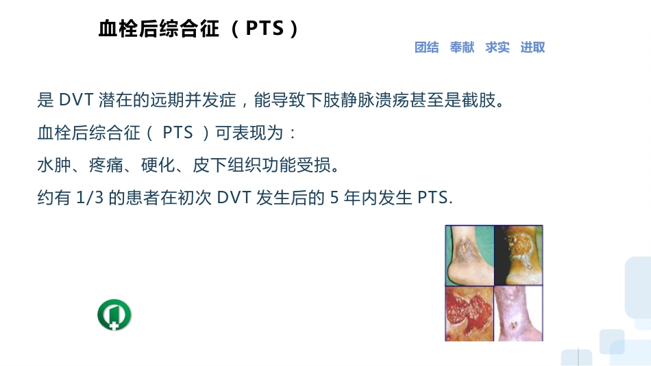 深静脉血栓的预防及护理ppt_第12页